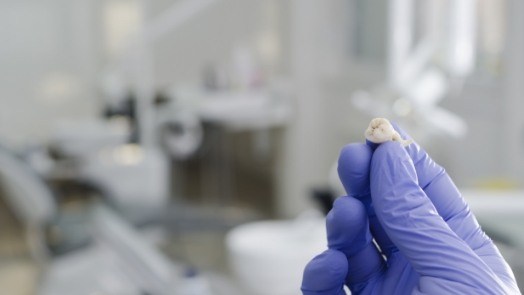 Dentist holding extracted tooth in gloved hand
