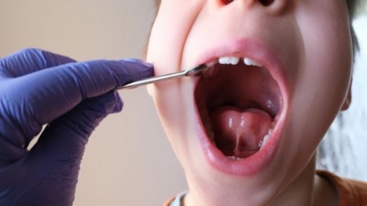 Dentist examining wide open mouth of a child