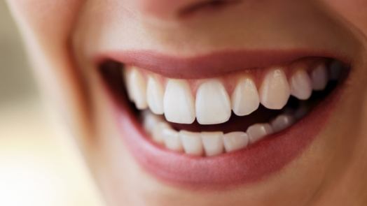 Close up of smile with straight white teeth