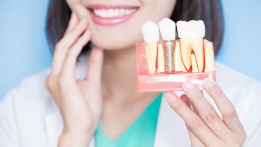 Smiling dentist holding model of dental implant