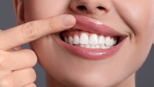 Close up of person pointing to her gums