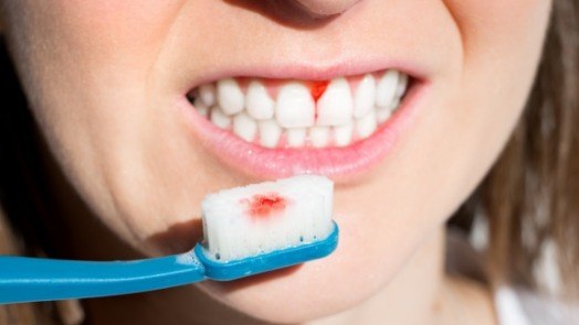 Person holding toothbrush with small blood stain