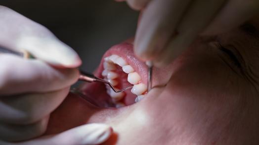 Close up of dentist treating a patient with gum disease