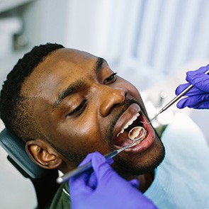 An African man receiving a dental checkup
