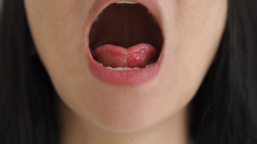 Close up of person opening their mouth wide
