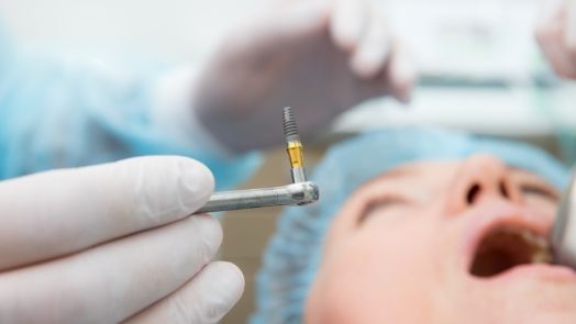 Dentist about to place a dental implant in the mouth of a patient