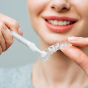 Person filling teeth whitening tray with bleaching gel