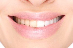 cosmetic dentist inTulsa OK